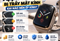 Apple Watch Bị Trầy Mặt Kính: Khi Nào Nên Ép Kính?